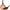 Bergner Q3402 Set 2 Piezas sartenes 20+24 